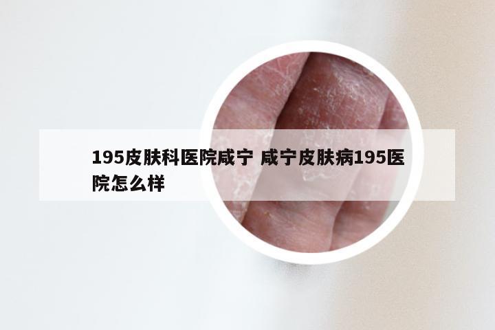 195皮肤科医院咸宁 咸宁皮肤病195医院怎么样