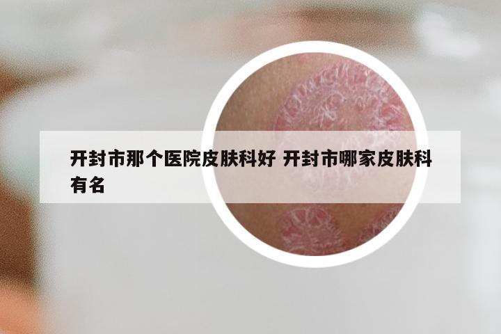 开封市那个医院皮肤科好 开封市哪家皮肤科有名