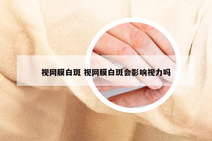 视网膜白斑 视网膜白斑会影响视力吗
