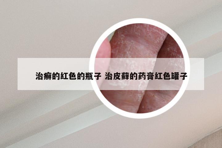 治癣的红色的瓶子 治皮藓的药膏红色罐子