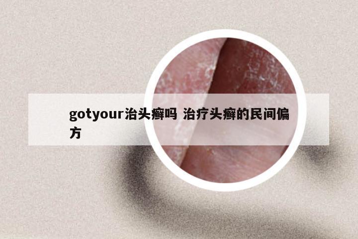 gotyour治头癣吗 治疗头癣的民间偏方
