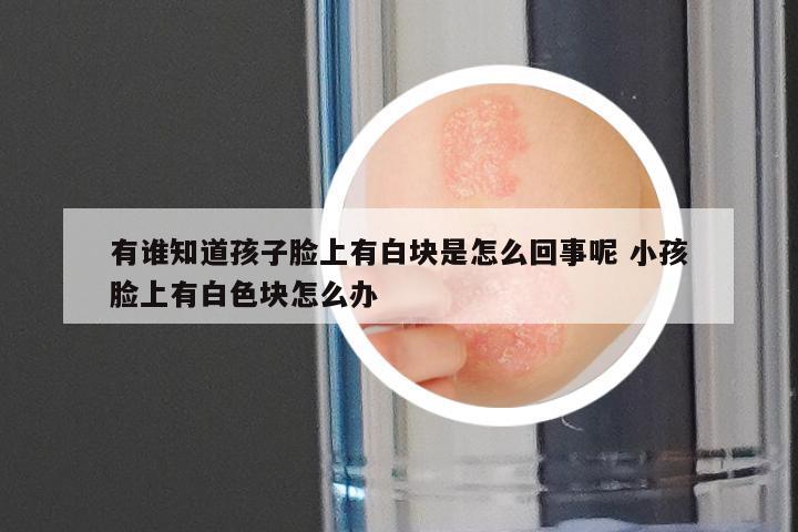 有谁知道孩子脸上有白块是怎么回事呢 小孩脸上有白色块怎么办