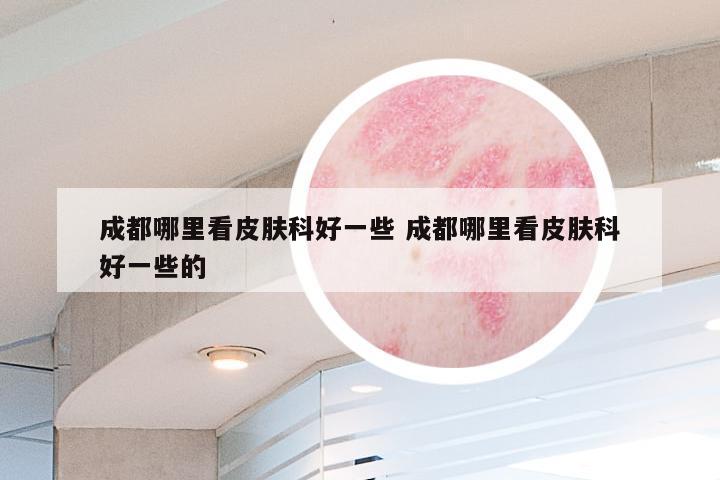 成都哪里看皮肤科好一些 成都哪里看皮肤科好一些的