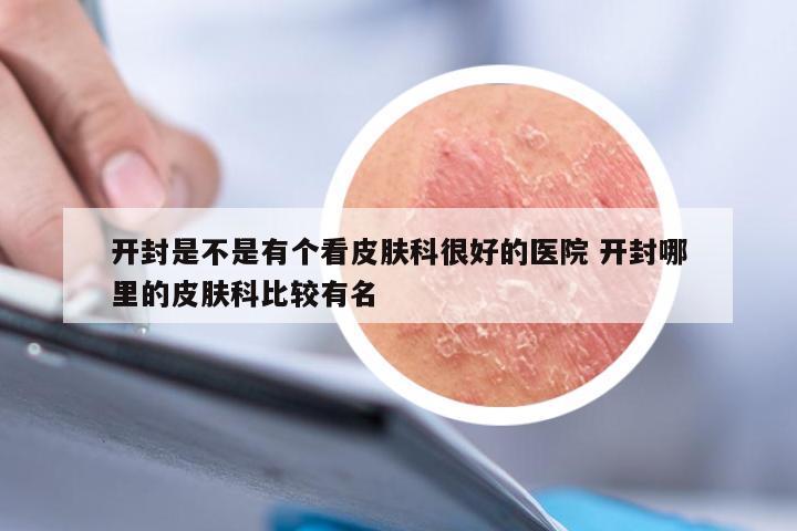开封是不是有个看皮肤科很好的医院 开封哪里的皮肤科比较有名