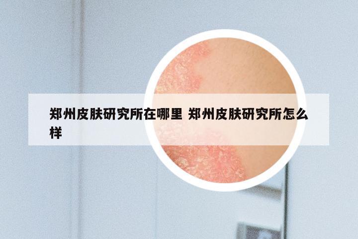 郑州皮肤研究所在哪里 郑州皮肤研究所怎么样