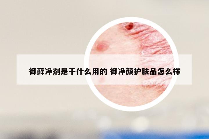 御藓净剂是干什么用的 御净颜护肤品怎么样