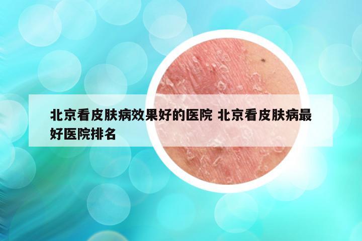 北京看皮肤病效果好的医院 北京看皮肤病最好医院排名