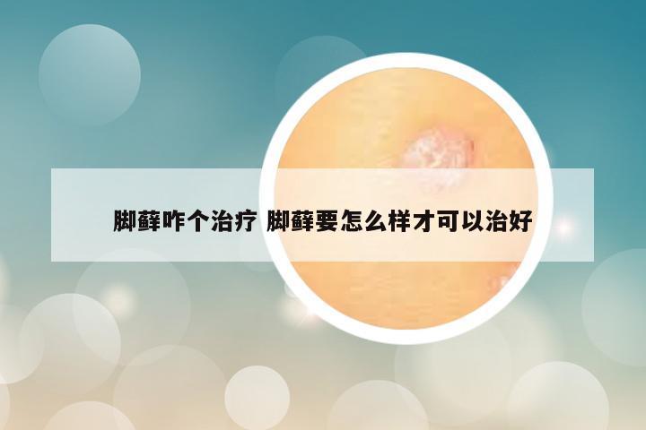 脚藓咋个治疗 脚藓要怎么样才可以治好