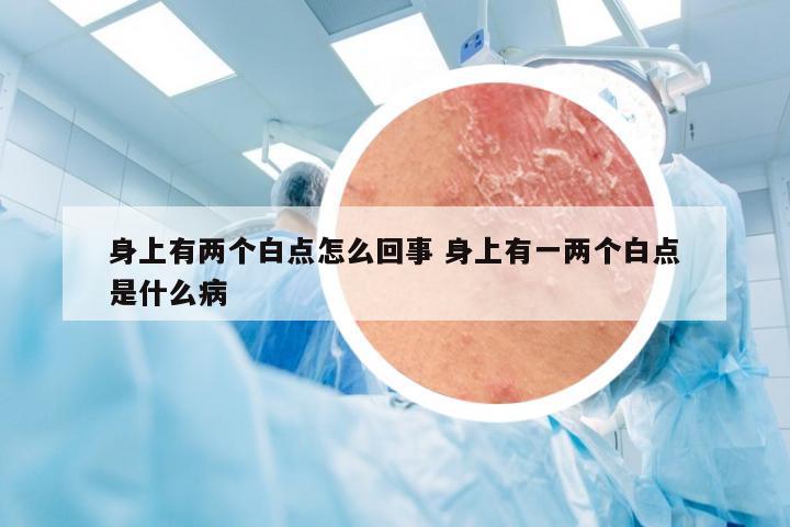 身上有两个白点怎么回事 身上有一两个白点是什么病