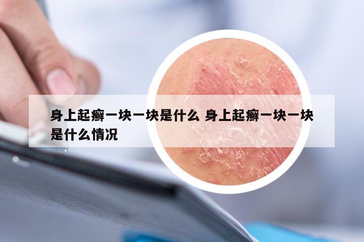 身上起癣一块一块是什么 身上起癣一块一块是什么情况