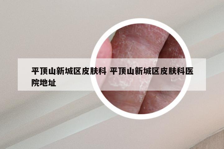 平顶山新城区皮肤科 平顶山新城区皮肤科医院地址
