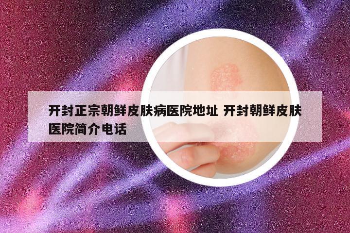 开封正宗朝鲜皮肤病医院地址 开封朝鲜皮肤医院简介电话