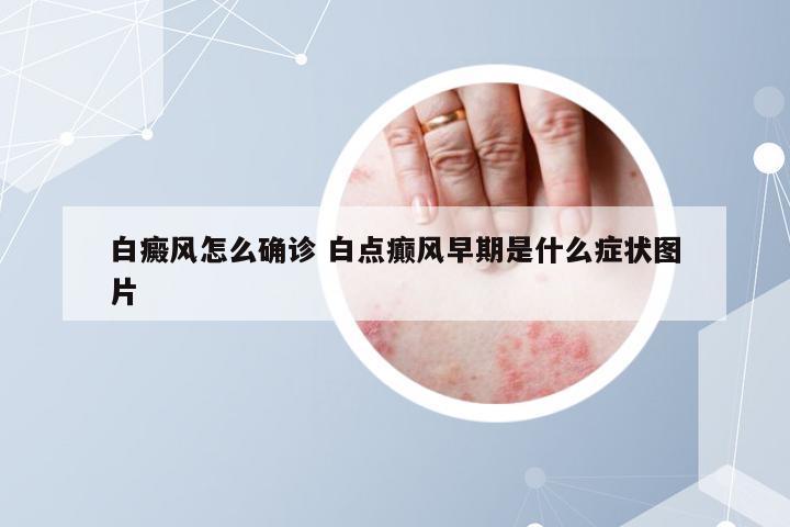白癜风怎么确诊 白点癫风早期是什么症状图片