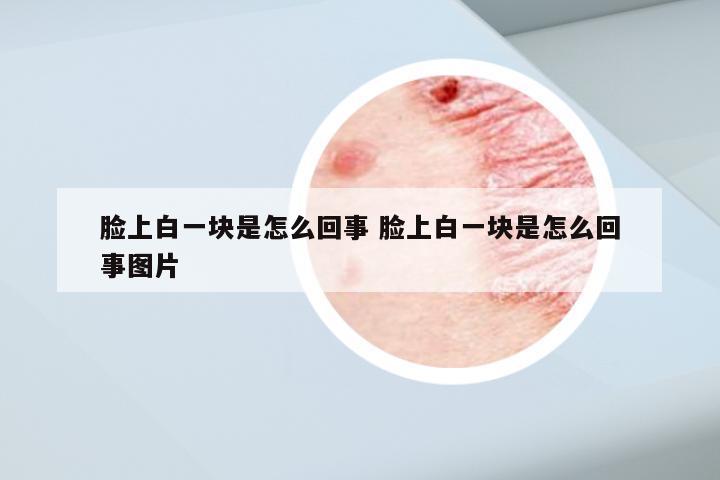 脸上白一块是怎么回事 脸上白一块是怎么回事图片