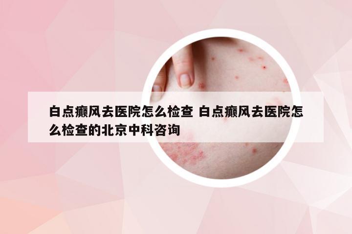 白点癫风去医院怎么检查 白点癫风去医院怎么检查的北京中科咨询