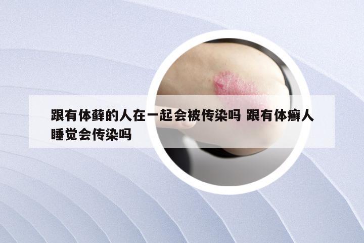 跟有体藓的人在一起会被传染吗 跟有体癣人睡觉会传染吗