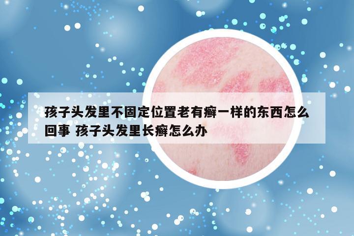 孩子头发里不固定位置老有癣一样的东西怎么回事 孩子头发里长癣怎么办