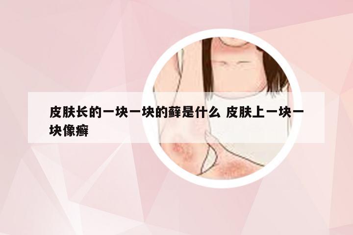皮肤长的一块一块的藓是什么 皮肤上一块一块像癣