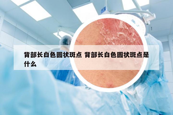 背部长白色圆状斑点 背部长白色圆状斑点是什么