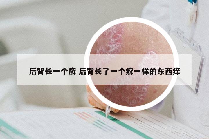 后背长一个癣 后背长了一个癣一样的东西痒