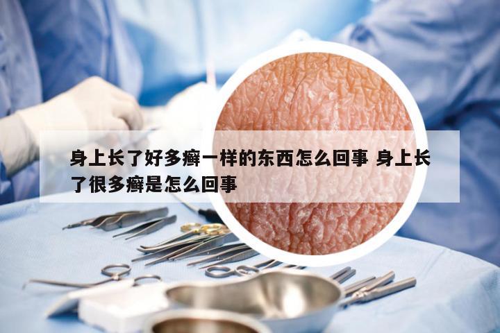 身上长了好多癣一样的东西怎么回事 身上长了很多癣是怎么回事
