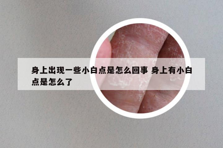 身上出现一些小白点是怎么回事 身上有小白点是怎么了