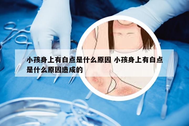 小孩身上有白点是什么原因 小孩身上有白点是什么原因造成的
