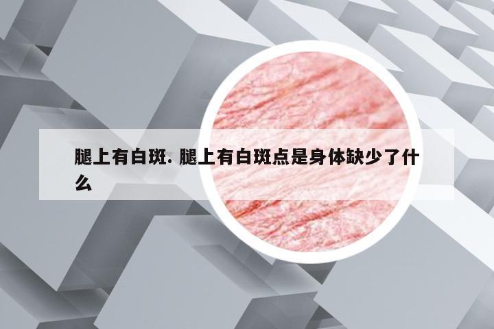 腿上有白斑. 腿上有白斑点是身体缺少了什么