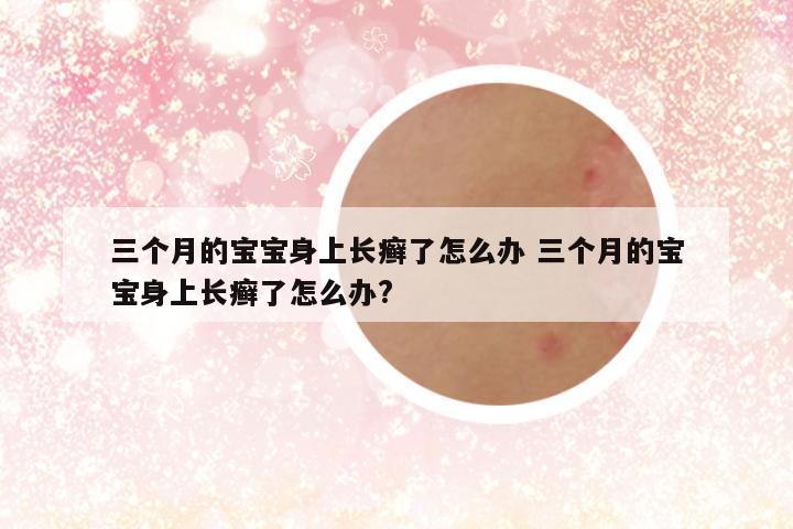 三个月的宝宝身上长癣了怎么办 三个月的宝宝身上长癣了怎么办?