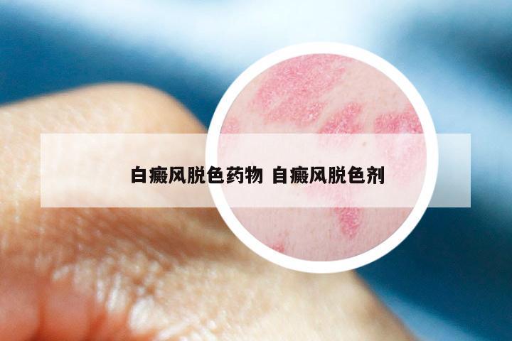 白癜风脱色药物 自癜风脱色剂