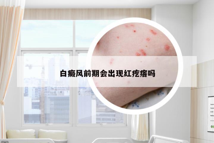 白癜风前期会出现红疙瘩吗