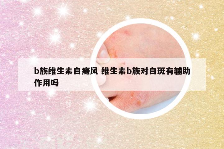 b族维生素白癜风 维生素b族对白斑有辅助作用吗