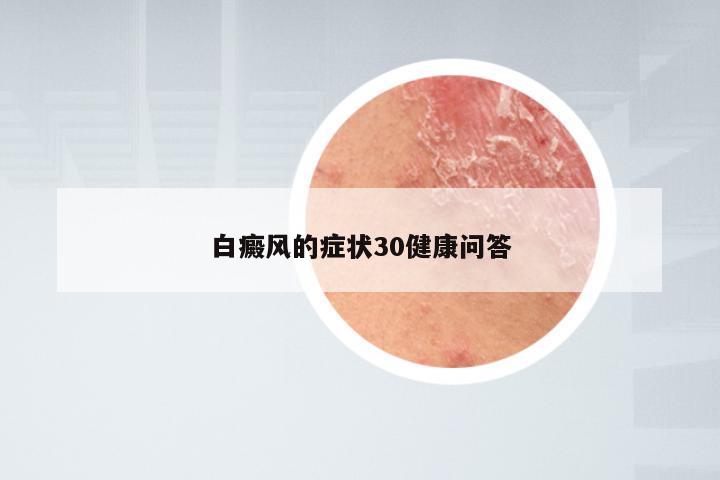 白癜风的症状30健康问答