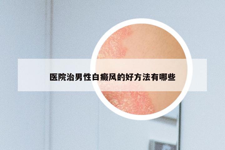 医院治男性白癜风的好方法有哪些