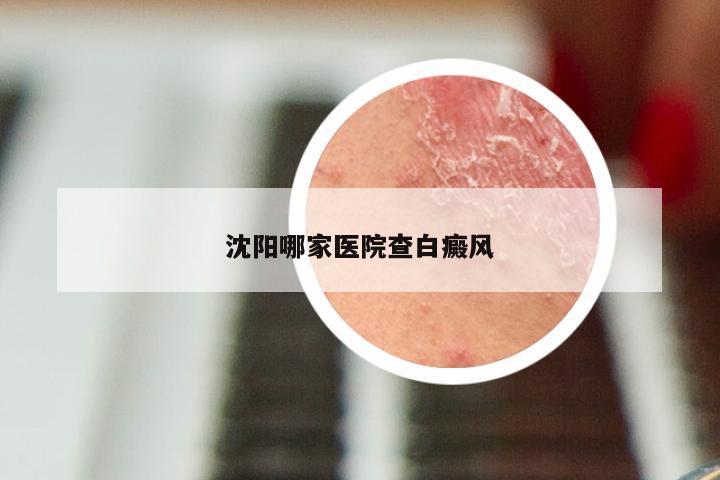 沈阳哪家医院查白癜风