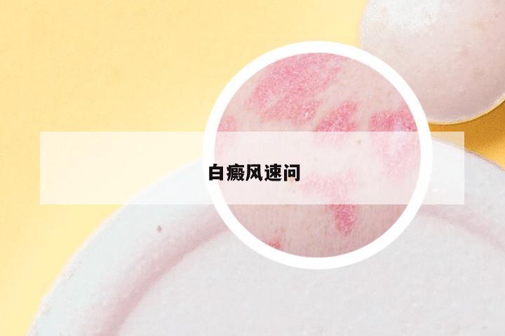 白癜风速问