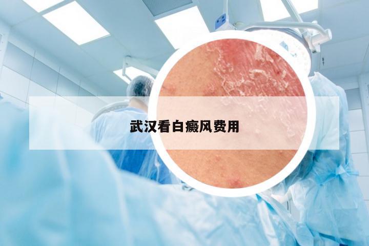 武汉看白癜风费用