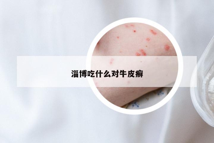 淄博吃什么对牛皮癣