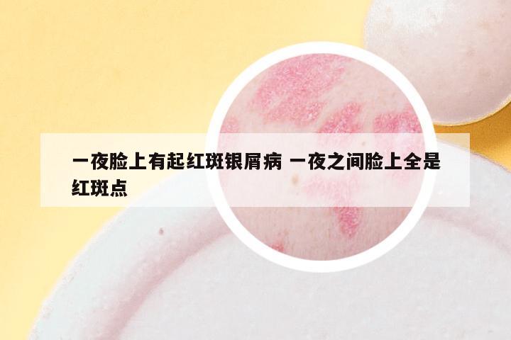 一夜脸上有起红斑银屑病 一夜之间脸上全是红斑点