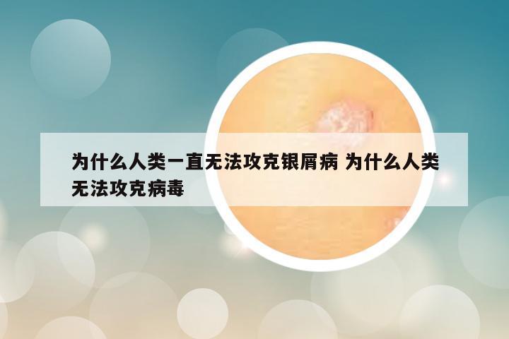 为什么人类一直无法攻克银屑病 为什么人类无法攻克病毒