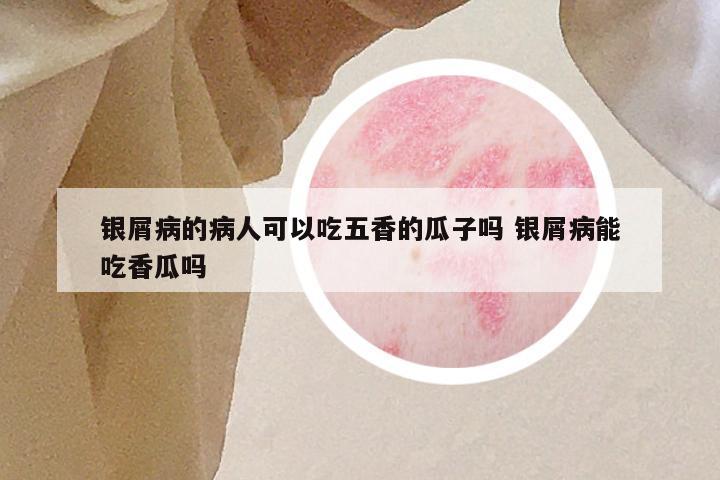 银屑病的病人可以吃五香的瓜子吗 银屑病能吃香瓜吗
