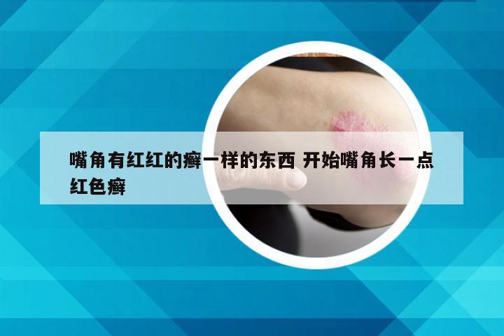嘴角有红红的癣一样的东西 开始嘴角长一点红色癣
