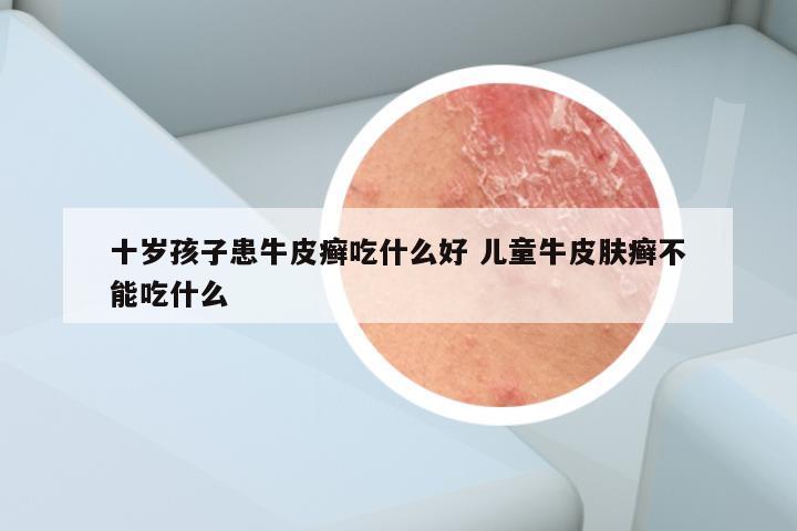 十岁孩子患牛皮癣吃什么好 儿童牛皮肤癣不能吃什么
