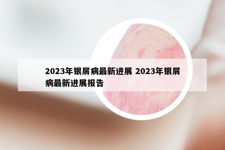 2023年银屑病最新进展 2023年银屑病最新进展报告