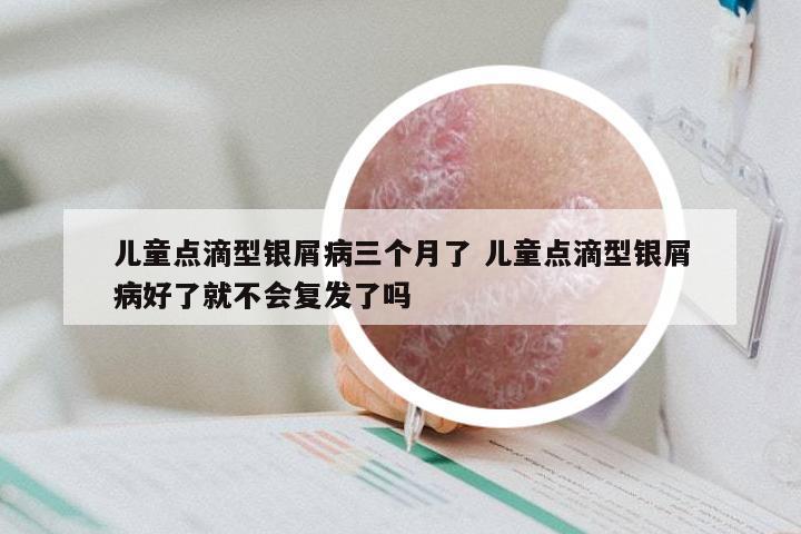 儿童点滴型银屑病三个月了 儿童点滴型银屑病好了就不会复发了吗