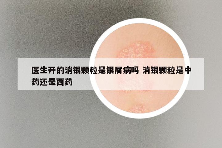医生开的消银颗粒是银屑病吗 消银颗粒是中药还是西药