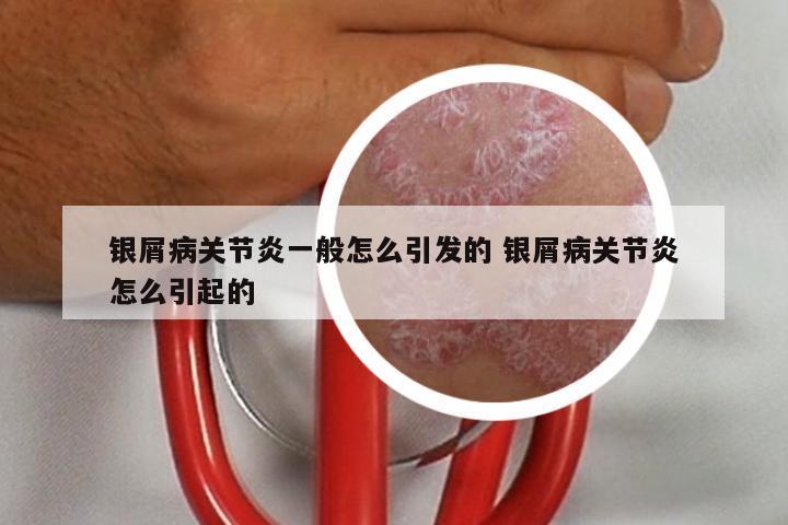 银屑病关节炎一般怎么引发的 银屑病关节炎怎么引起的