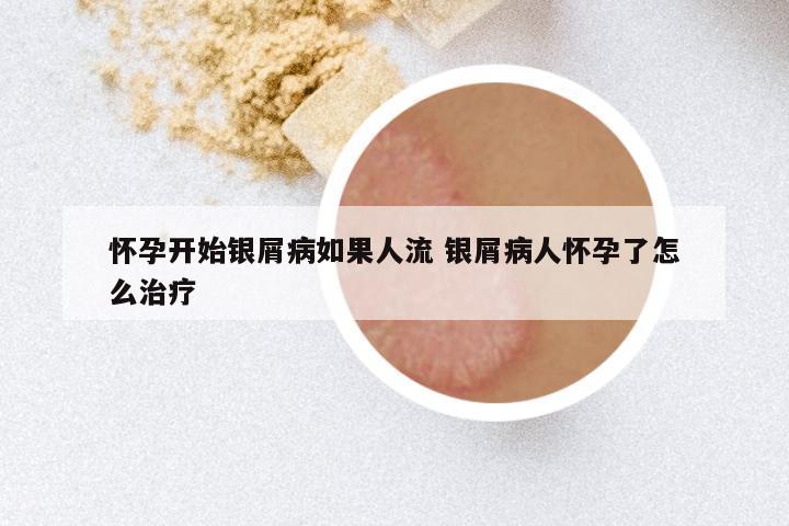 怀孕开始银屑病如果人流 银屑病人怀孕了怎么治疗