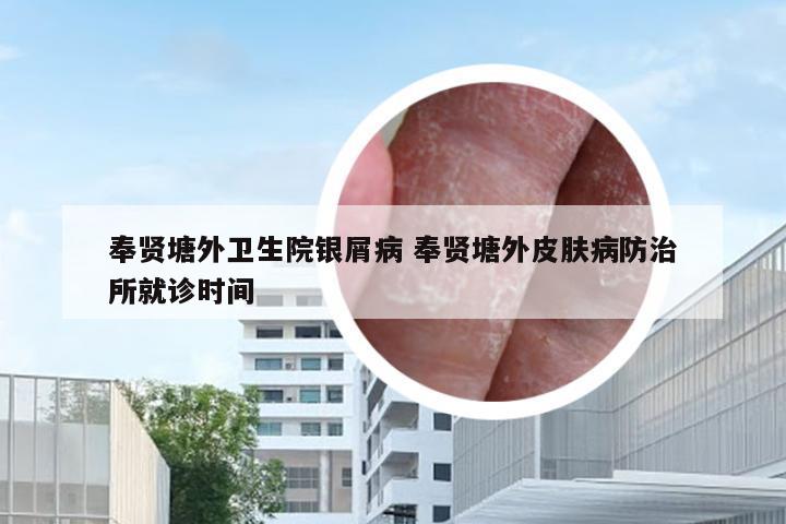 奉贤塘外卫生院银屑病 奉贤塘外皮肤病防治所就诊时间