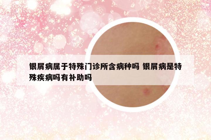 银屑病属于特殊门诊所含病种吗 银屑病是特殊疾病吗有补助吗